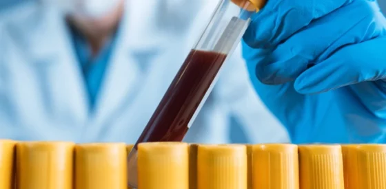 Transport von Zytostatika